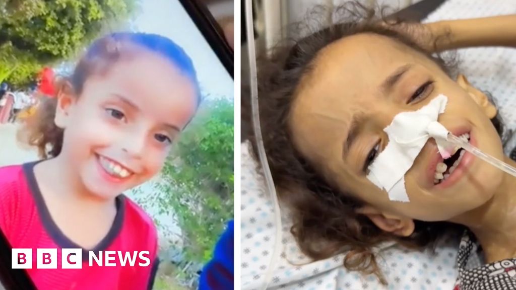 Gaza mother blames famine for halving daughter's weight