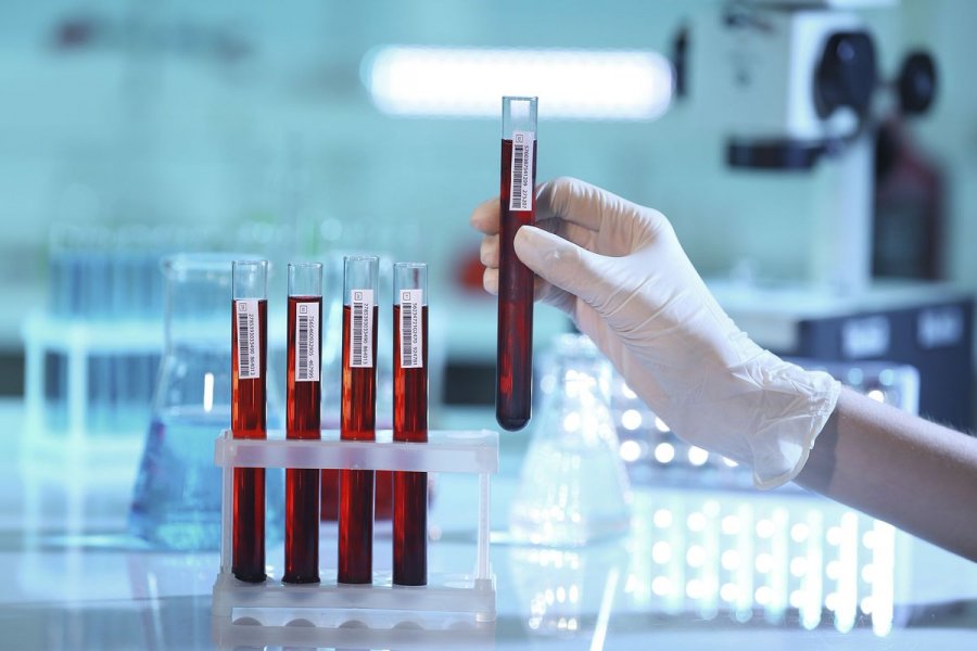 An increase in the incidence of acute respiratory viral infections has been recorded in Russia - Ореанда-Новости