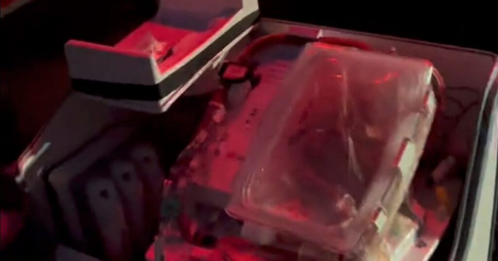 Incredible rare viral clip shows live beating heart in box ready for transplant