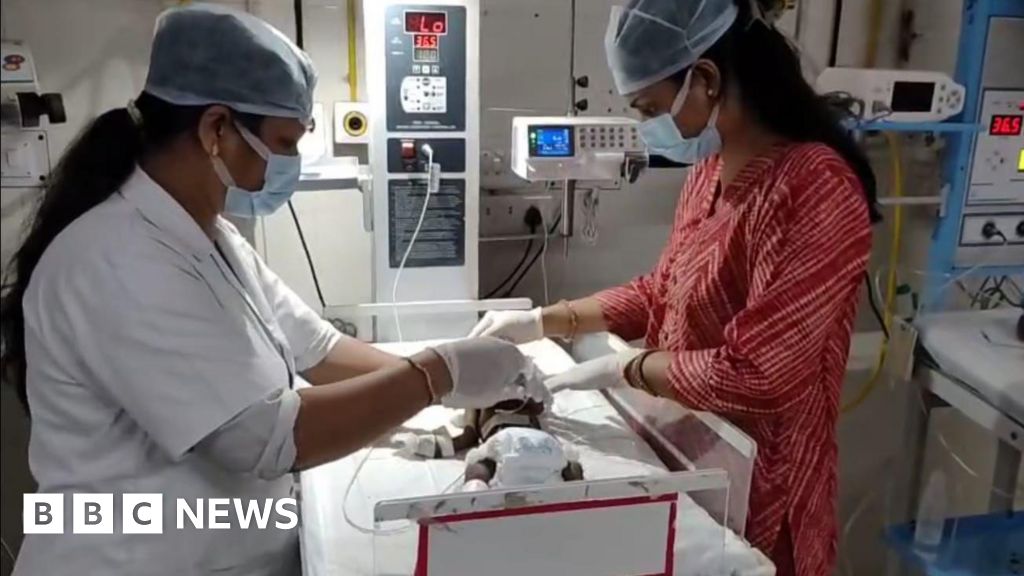 India 20-day-old baby girl found buried fighting for life