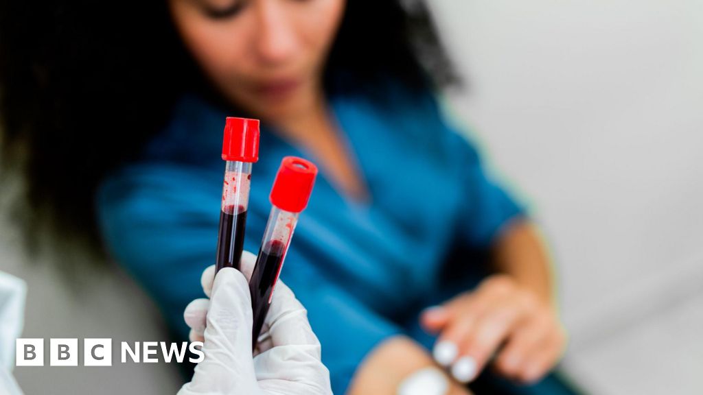Exciting results from blood test for 50 cancers