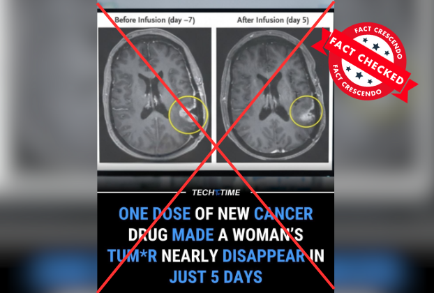 Viral Claim About "Single Dose" Cancer Drug Causing Tumor to Vanish in 5 Days Is Misleading - Fact Crescendo Sri Lanka English