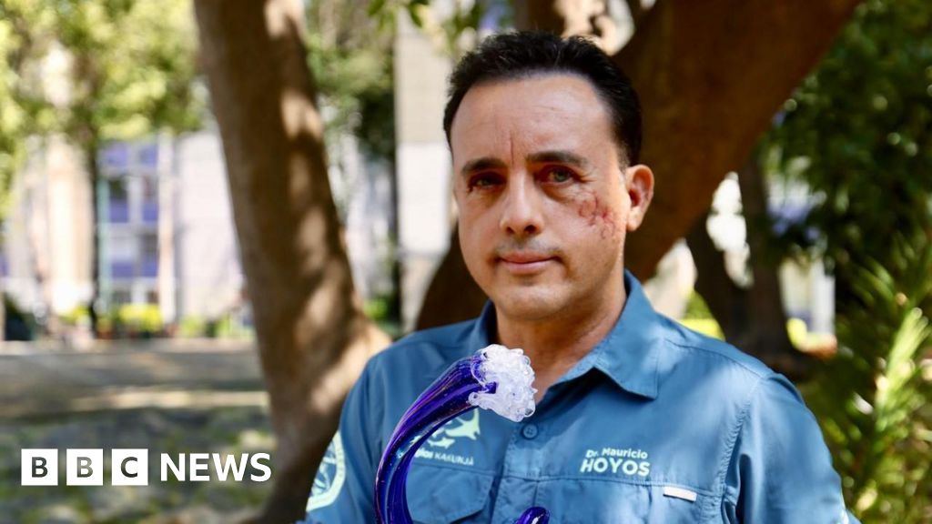 Biologist bitten in head by shark hopes to meet animal again