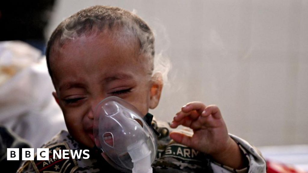 Children are hit hardest by toxic air in Indian capital