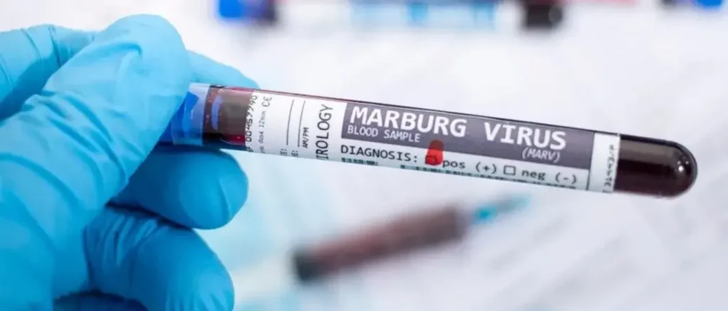 Marburg virus disease outbreak confirmed in Ethiopia